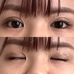 口コミ