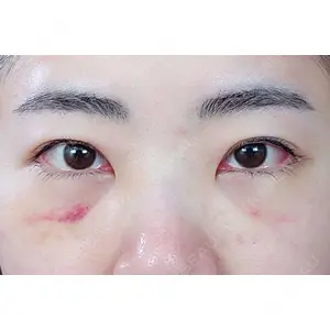 東京イセアクリニック口コミ