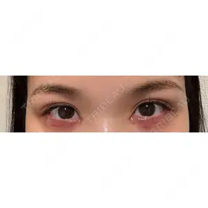 HAAB×DREAM BEAUTY CLINIC HAAB×DREAM BEAUTY CLINIC 大阪梅田院口コミ
