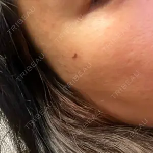 ルラ美容クリニック ルラ美容クリニック 広島院口コミ