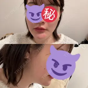 口コミ