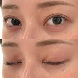 水の森美容クリニックの口コミ