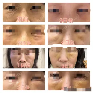 YBC横浜美容外科の口コミ