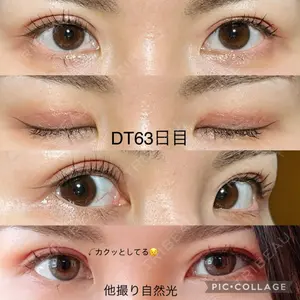 BIANCA CLINIC BIANCA銀座口コミ