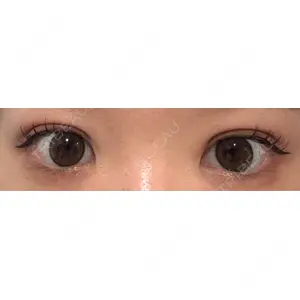 口コミ