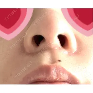 口コミ