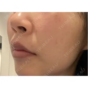 CHARIS BEAUTY CLINIC口コミ