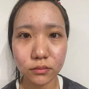 LUHO（ルホ）美容外科口コミ