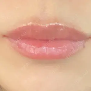 アネシス美容クリニック口コミ