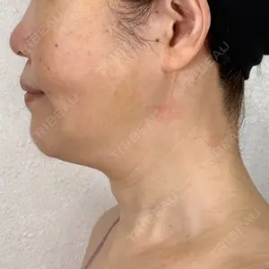 アリエル美容クリニック アリエル美容クリニック 横浜院口コミ