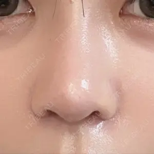 LUHO（ルホ）美容外科口コミ