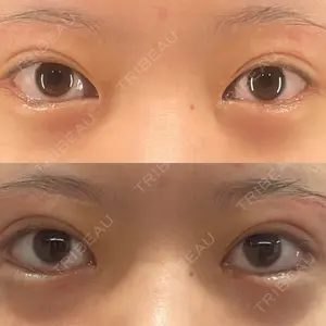 BIANCA CLINIC BIANCA銀座口コミ