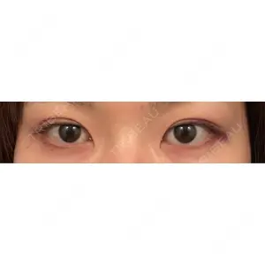 口コミ