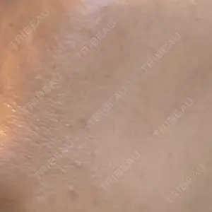 心斎橋KT美容クリニック口コミ