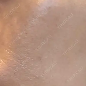 美容皮膚科 デュークリニック口コミ