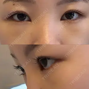 銀座みゆき通り美容外科 大阪梅田院の