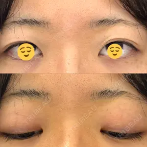 オアシス美容外科口コミ