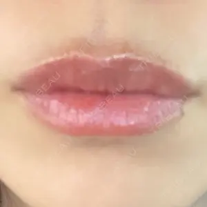 アネシス美容クリニック口コミ