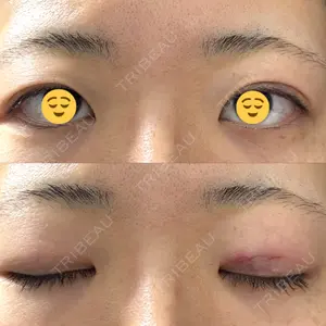 オアシス美容外科口コミ