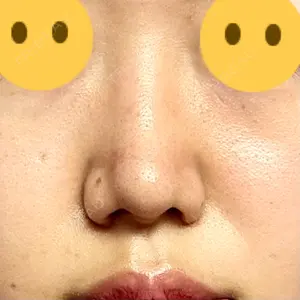 口コミ