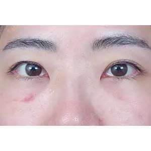 東京イセアクリニック口コミ