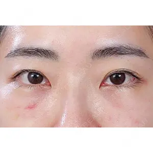 東京イセアクリニック口コミ