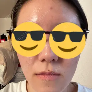 ミニマムスキンクリニック池袋口コミ
