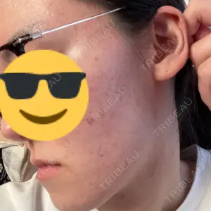 ミニマムスキンクリニック ミニマムスキンクリニック池袋口コミ