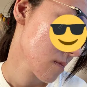 ミニマムスキンクリニック ミニマムスキンクリニック池袋口コミ