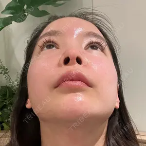9BeautyClinic口コミ
