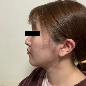 東京シンデレラ美容外科 東京シンデレラ美容外科 池袋院口コミ