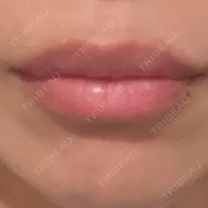 アネシス美容クリニック口コミ