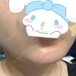 口コミ