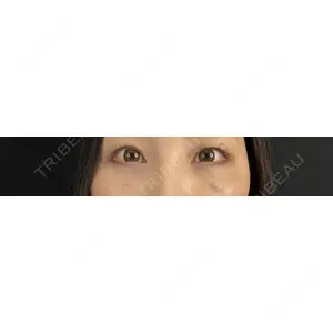 藤・ナチュレ美容クリニック 藤・ナチュレ美容クリニック 銀座院口コミ