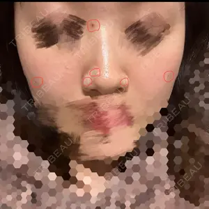 口コミ
