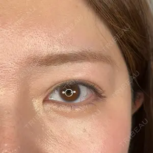 アリエル美容クリニック アリエル美容クリニック 大宮院口コミ