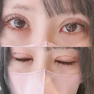 口コミ