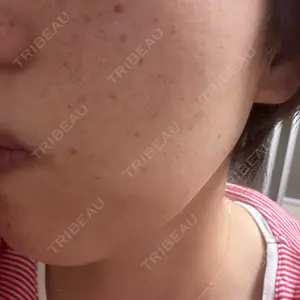 CZEN CLINIC 銀座院口コミ