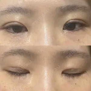 ルラ美容クリニック ルラ美容クリニック 高田馬場院口コミ