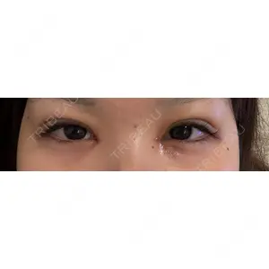 口コミ