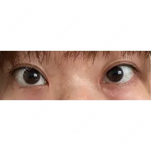 東京シンデレラ美容外科 東京シンデレラ美容外科 池袋院口コミ