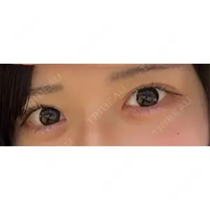 アリエル美容クリニック アリエル美容クリニック 大宮院口コミ