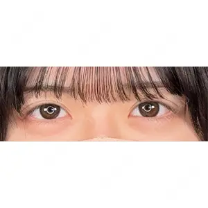アリエル美容クリニック アリエル美容クリニック 大宮院口コミ