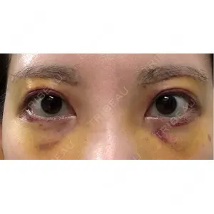 PRO CLINIC プロクリニック 銀座院口コミ