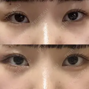 銀座みゆき通り美容外科 大阪梅田院の