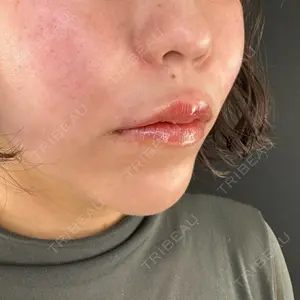 ルラ美容クリニック ルラ美容クリニック 大阪本院口コミ