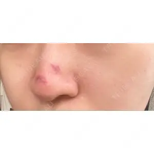 藤・ナチュレ美容クリニック 銀座院の