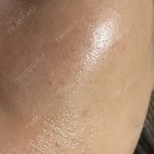 心斎橋KT美容クリニック口コミ