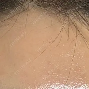 心斎橋KT美容クリニック口コミ