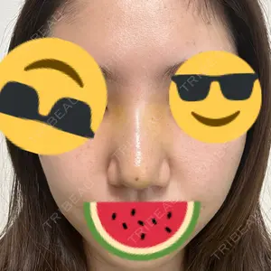 TCB東京中央美容外科 福岡天神院の